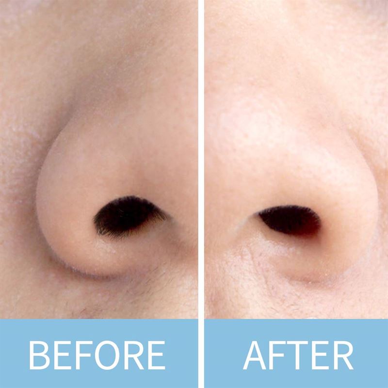 UNIQ Nose wax sticks 20 pcs. - | Fashiongirl